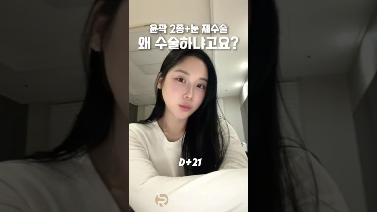 넓은 광대와 사각턱, 풀린 쌍꺼풀로 고민하던 환자분이 윤곽 2종과 절개 재수술을 진행하셨습니다. 수술 후 갸름한 얼굴선과 또렷한 눈매로 한층 부드럽고 세련된 인상으로 변화했습니다✨